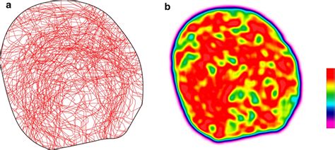 The fracture maps and heatmaps for complex fractures. Fractures were ...