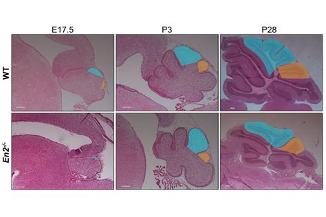 Cerebellum development and regeneration | Sloan Kettering Institute