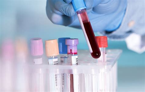 GENES2ME Blood Test, Rs 999 /unit Imperial Life Sciences Private Limited | ID: 21149500612