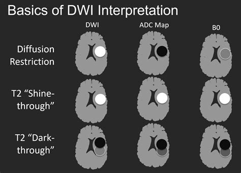 KunerMD @KunerMd · MRI 101:... - Radiology Students Of A.M.S | Facebook