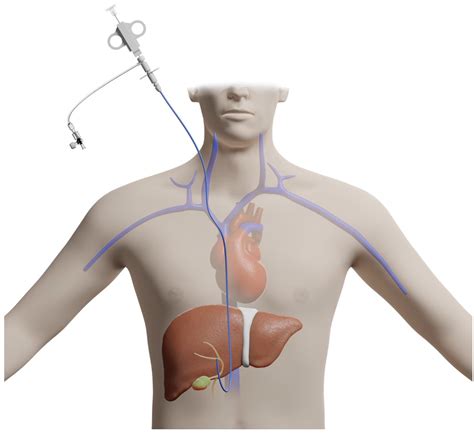 Diagnostics | Free Full-Text | Advances in Endoscopic Ultrasound (EUS ...