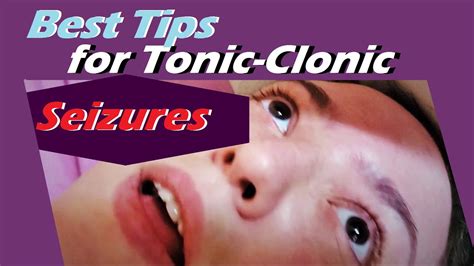Tonic clonic generalized (grand mal) seizure packed with epilepsy tips - YouTube