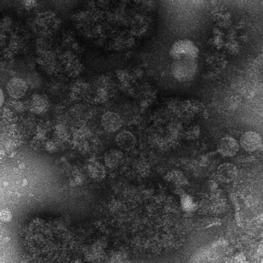 Transmission electron microscopy images of polyomavirus in negative ...