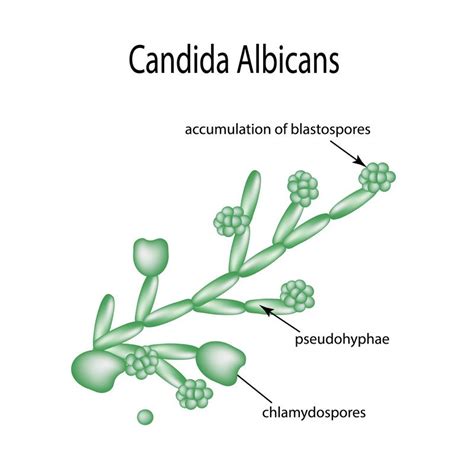 Candidiasis Guide: Causes, Symptoms and Treatment Options