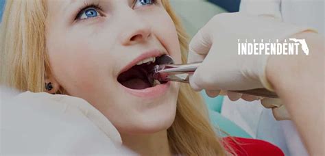 Cost of Tooth Extraction With (And Without) Insurance - Florida Independent