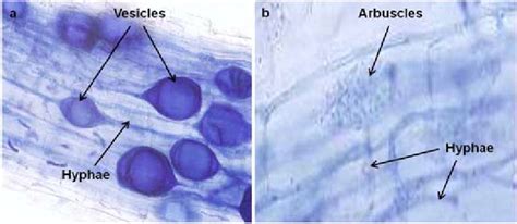 Microscopic visualization of arbuscular mycorrhizal fungi (a) showing ...