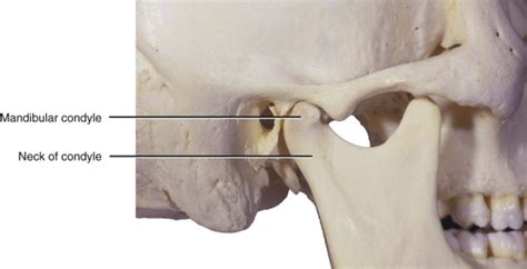 FRACTURE OF MANDIBULAR CONDYLE MANAGEMENT ITS CONTROVERSIES