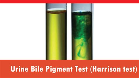 Urine bile pigment test procedure: Harrison & Foam Method: