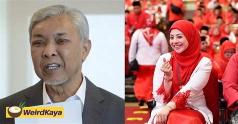 Zahid Hamidi's Swollen Eyes Concerns Netizens, Daughter Says It Isn't ...