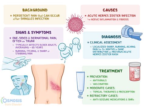 Postherpetic Neuralgia: What Is It, Causes, Symptoms, and More | Osmosis