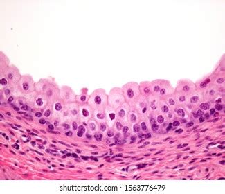 Transitional Epithelium Tissue