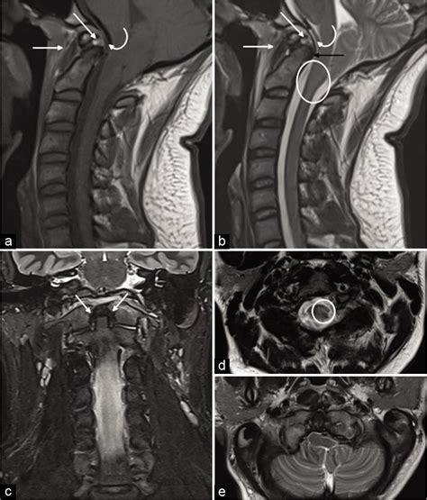 Surgical Neurology International