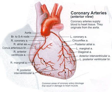 Pin by Silvia Bleahu on Medicine | Coronary arteries, Arteries, Coronary