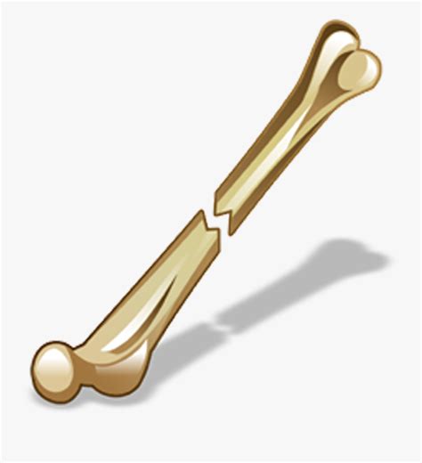 Bone Fracture Icon - Bone Fracture , Free Transparent Clipart - ClipartKey