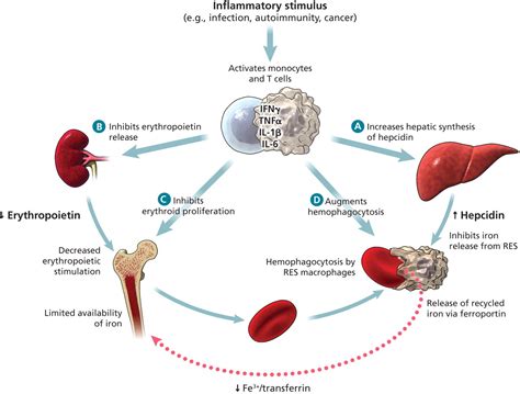 Anemia of chronic disease. Causes, symptoms, treatment Anemia of chronic disease