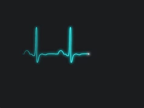 javascript - Animate ecg pulse line builded with border and border-radius - Stack Overflow