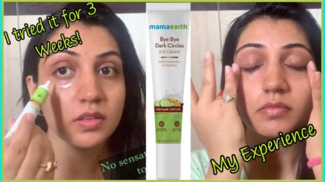 Mamaearth Bye Bye Dark Circles| Results after 3 weeks of use| My ...