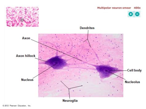 Multipolar Neuron Labeled Under Microscope