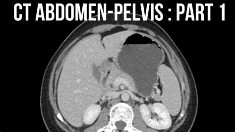 CT ABDOMEN PART 1 - INDICATIONS, PREPARATION #abdomenanatomy #ctabdomen #stomach #liver #kidney ...