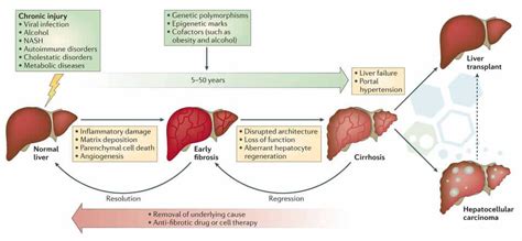 Stem Cell Therapy for Liver Disease & Cirrhosis of The Liver