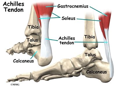 Achilles Tendon Problems | eOrthopod.com