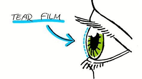 eyeblink - dry eye syndrome, information and treatment