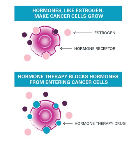 Breast cancer study tests pairing hormone therapy with immunotherapy ...