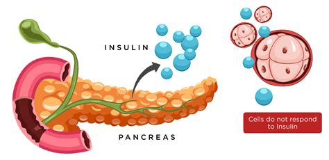 Insulin Which Is Produced by the Pancreas Is Used to...