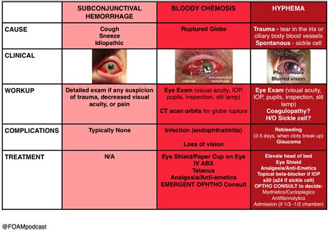 Hyphema, Subconjunctival hemorrhage, and bloody chemosis – FOAMcast