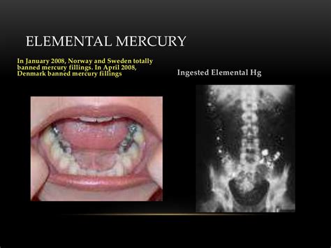 Toxicity of Heavy Metals