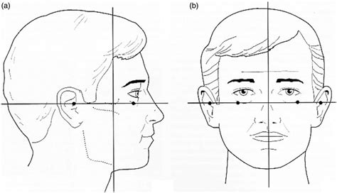 Position of the Frankfort Horizontal. | Download Scientific Diagram