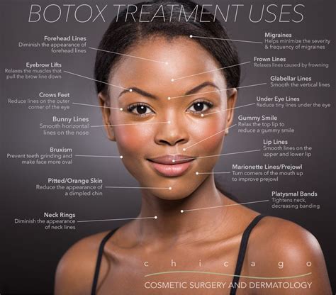 Botox, Dysport, Daxxify | Chicago Cosmetic Surgery and Dermatology | Botox, Botox fillers ...