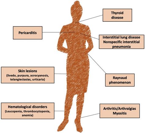 Frontiers | Undifferentiated Connective Tissue Disease in Pregnancy: A Topic Yet to be Explored