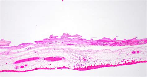 Pathology Outlines - Anatomy, histology & embryology