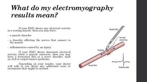 Electromyography - online presentation