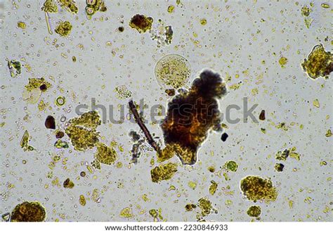 Soil Fungi Agriculture Soil Stock Photo 2230846933 | Shutterstock