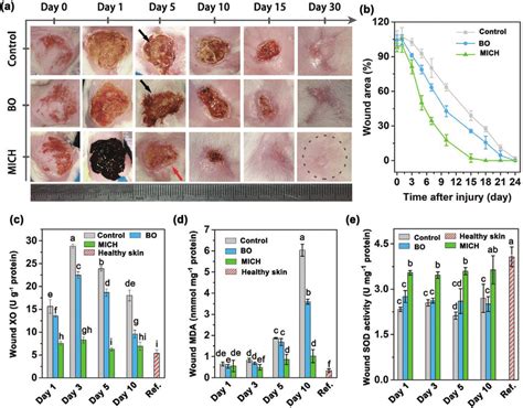 The wound healing under different treatments and burn-induced oxidative... | Download Scientific ...