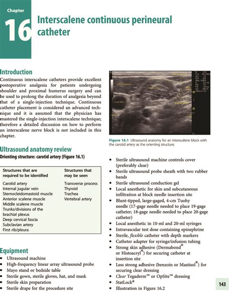 Interscalene continuous perineural catheter (Chapter 16) - Ultrasound-Guided Regional Anesthesia