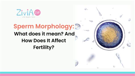 Sperm Morphology: What does it mean? and How Does It Affect Fertility ...