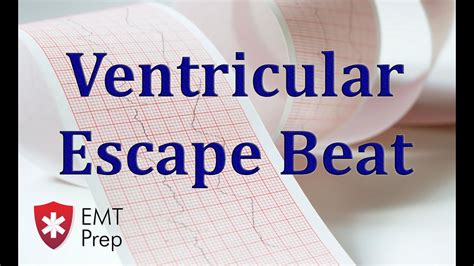 Ventricular Escape Beat ECG - EMTprep.com - YouTube