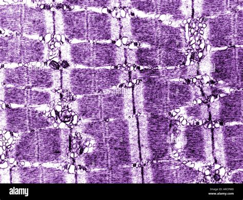 A transmission electron micrograph (TEM) of striated skeletal muscle Stock Photo: 9150655 - Alamy