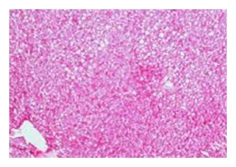 Photomicrographs in liver sections stained with Periodic-Sheif... | Download Scientific Diagram