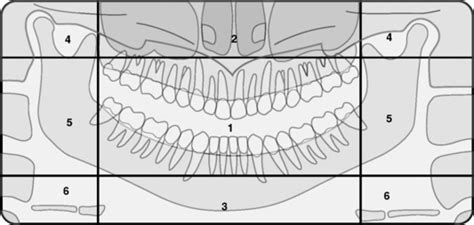 7: Panoramic Radiography: Errors Seen in Radiographs | Pocket Dentistry