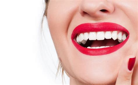 Common Side Effects of Teeth Whitening – Peel Dental Studio