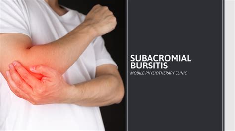 Subacromial Bursitis - Samarpan Physiotherapy Clinic Ahmedabad