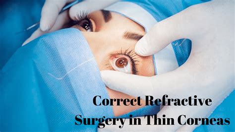 Correct refractive surgery in Thin Corneas | LASIK | EyeMantra