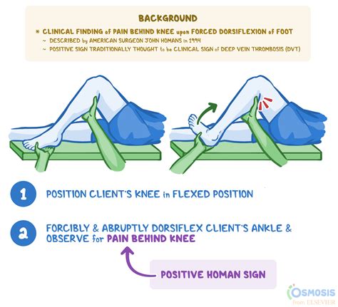 Homan Sign: What Is It, Uses, and More | Osmosis