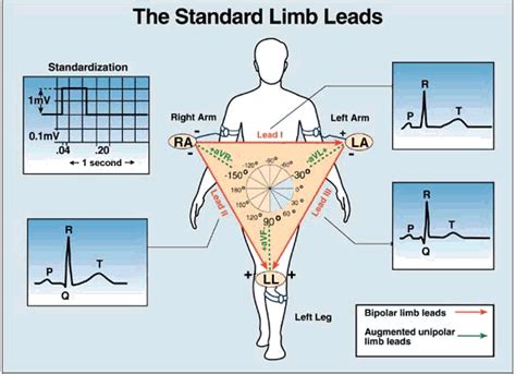 ECG Learning Center - An introduction to clinical electrocardiography