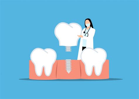 Dental Implant Free Stock Photo - Public Domain Pictures