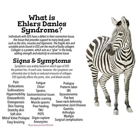 Ehlers-Danlos syndrome: My 47-year search for the right diagnosis